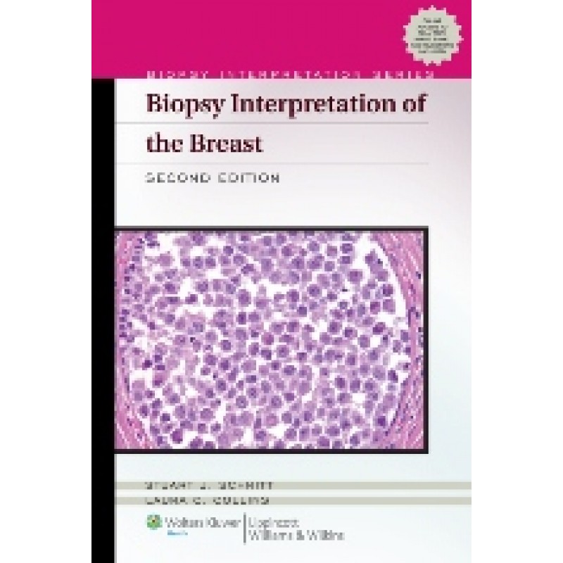 Biopsy Interpretation of the Breast , 2/e